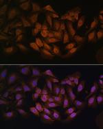 ZNF9 Polyclonal Antibody