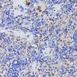Cdc23 Antibody in Immunohistochemistry (Paraffin) (IHC (P))