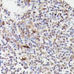 Cdc23 Polyclonal Antibody