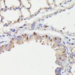 Cdc23 Antibody in Immunohistochemistry (Paraffin) (IHC (P))