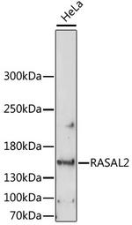 RASAL2 Polyclonal Antibody