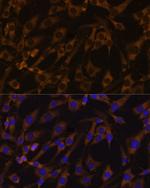 eIF5B Antibody in Immunocytochemistry (ICC/IF)