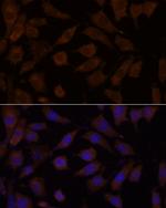 OXSR1 Polyclonal Antibody