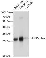 RNAse H2A Antibody in Western Blot (WB)
