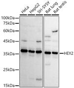 HEY2 Polyclonal Antibody