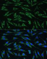 Dynamin 3 Polyclonal Antibody