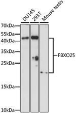 FBXO25 Polyclonal Antibody