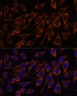 PYCR2 Polyclonal Antibody