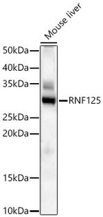 TRAC-1 Polyclonal Antibody