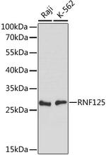 TRAC-1 Polyclonal Antibody