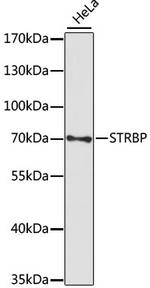 STRBP Polyclonal Antibody