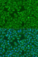 IGF2BP1 Polyclonal Antibody