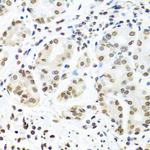 IGF2BP1 Antibody in Immunohistochemistry (Paraffin) (IHC (P))