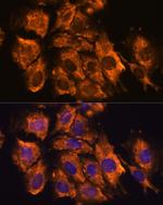 CRELD1 Antibody in Immunocytochemistry (ICC/IF)