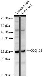 COQ10B Polyclonal Antibody