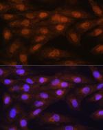 PRMT5 Antibody in Immunocytochemistry (ICC/IF)