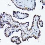 PRMT5 Antibody in Immunohistochemistry (Paraffin) (IHC (P))