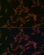 OTUD4 Antibody in Immunocytochemistry (ICC/IF)