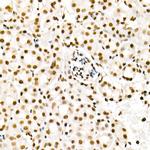 H4K5ac Polyclonal Antibody
