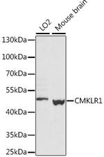 CMKLR1 Polyclonal Antibody