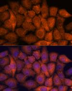 RPAP3 Antibody in Immunocytochemistry (ICC/IF)