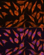 RPAP3 Polyclonal Antibody