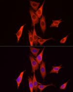 Caspase 7 p11 Polyclonal Antibody