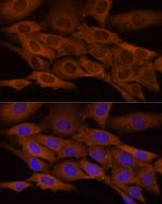 ATP Citrate Lyase Polyclonal Antibody
