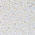 Catenin alpha-1 Antibody in Immunohistochemistry (Paraffin) (IHC (P))