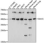 GALK1 Polyclonal Antibody