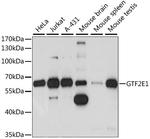 GTF2E1 Antibody in Western Blot (WB)