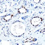 FOXA1 Polyclonal Antibody