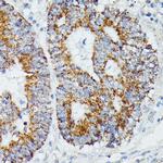 IVD Polyclonal Antibody