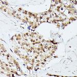 KID Polyclonal Antibody