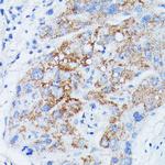 MANBA Antibody in Immunohistochemistry (Paraffin) (IHC (P))