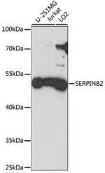 SERPINB2 Polyclonal Antibody