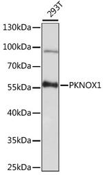 PKNOX1 Antibody in Western Blot (WB)