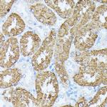 PLS1 Antibody in Immunohistochemistry (Paraffin) (IHC (P))