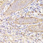PSMG1 Polyclonal Antibody