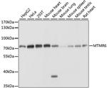 MTMR6 Polyclonal Antibody