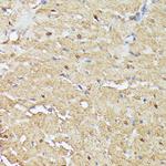 ASC1 Antibody in Immunohistochemistry (Paraffin) (IHC (P))