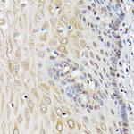 ASC1 Antibody in Immunohistochemistry (Paraffin) (IHC (P))