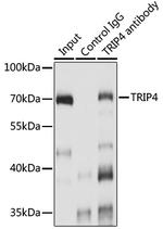 ASC1 Antibody in Immunoprecipitation (IP)