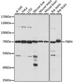 ASC1 Antibody in Western Blot (WB)