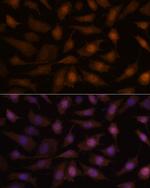 EEF1E1 Polyclonal Antibody