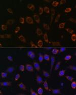 TCIRG1 Antibody in Immunocytochemistry (ICC/IF)