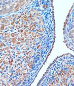 TCIRG1 Antibody in Immunohistochemistry (Paraffin) (IHC (P))
