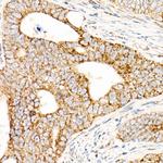 AFG3L2 Polyclonal Antibody