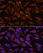 VIP36 Polyclonal Antibody