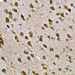 CPEB3 Polyclonal Antibody